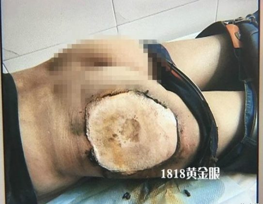 dd90006149953bd7769-e1473575708496