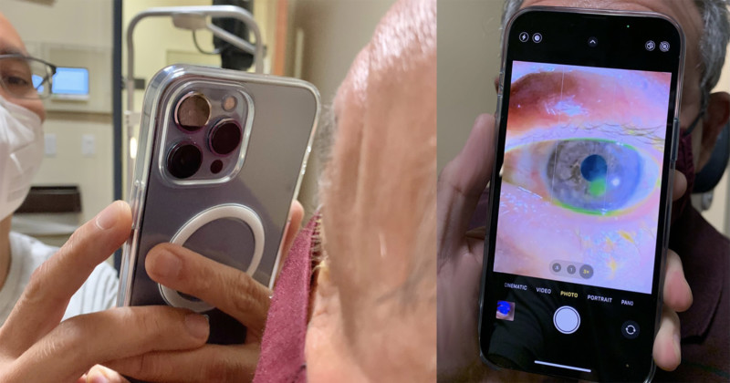 El oftalmólogo que usa la nueva función macro del iPhone 13 en su trabajo responde a las críticas que recibió