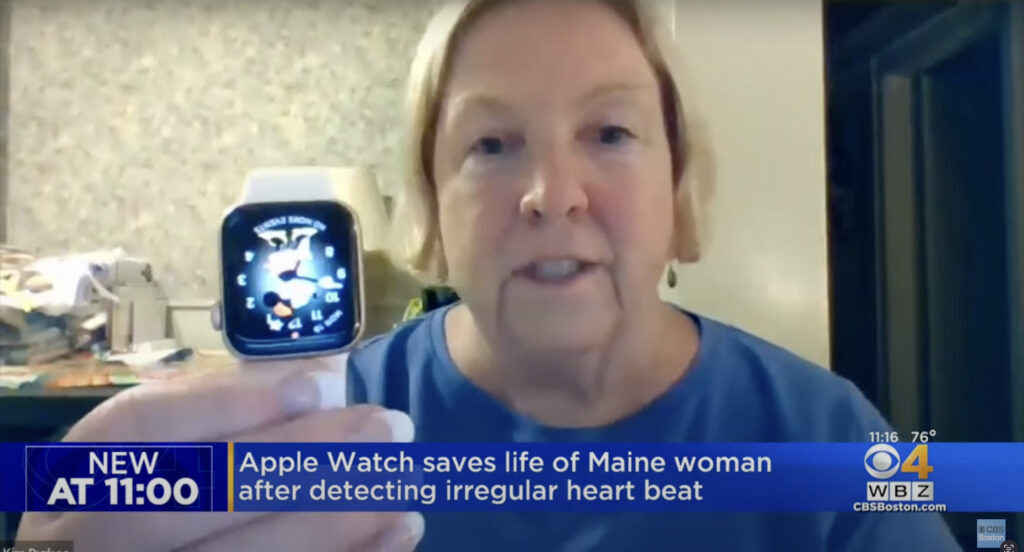 Un Apple Watch salva la vida de una mujer de 67 años detectando una fibrilación producto de un oculto tumor mortal