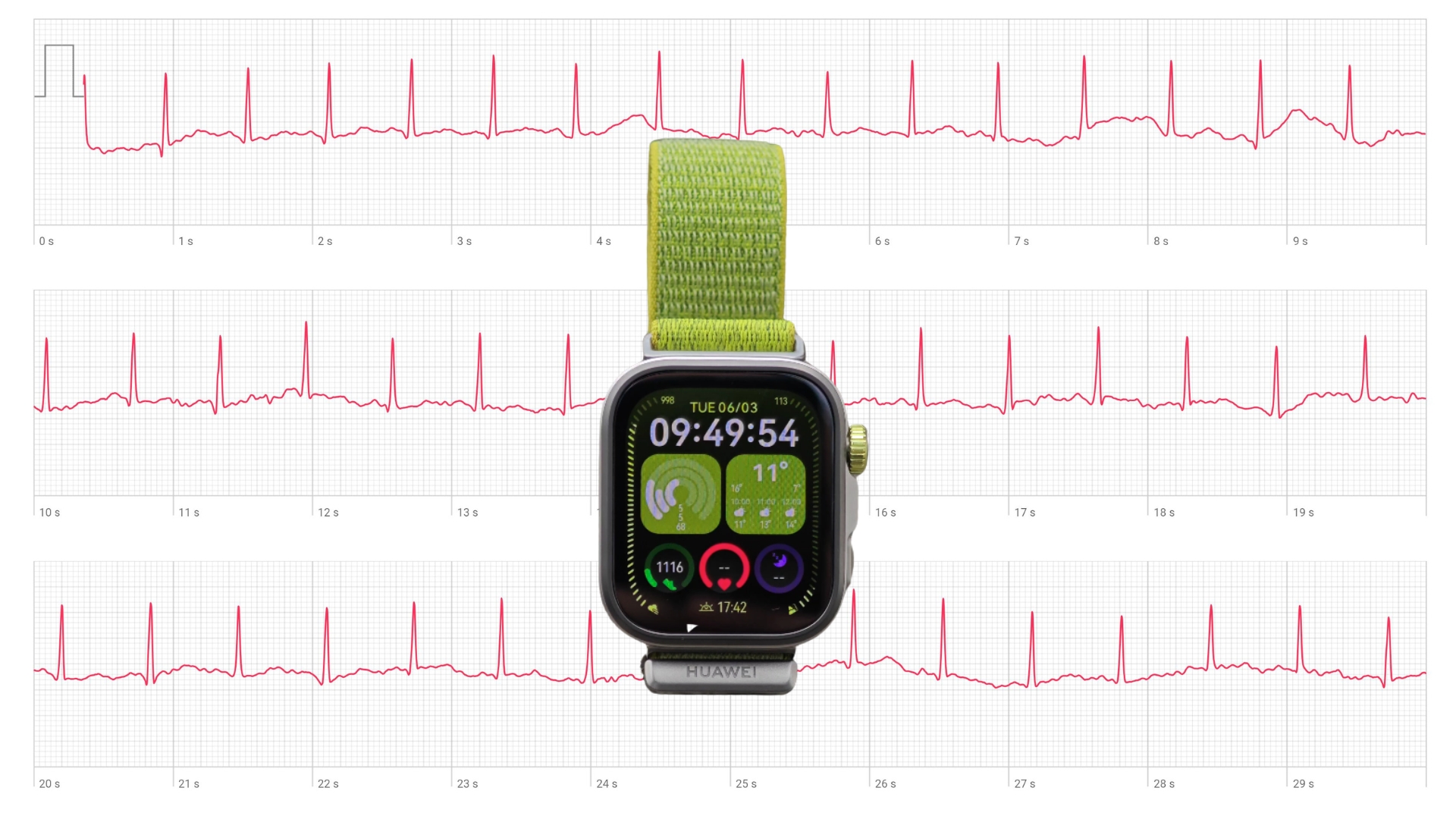 Huawei watch Fit 4 Pro ecg