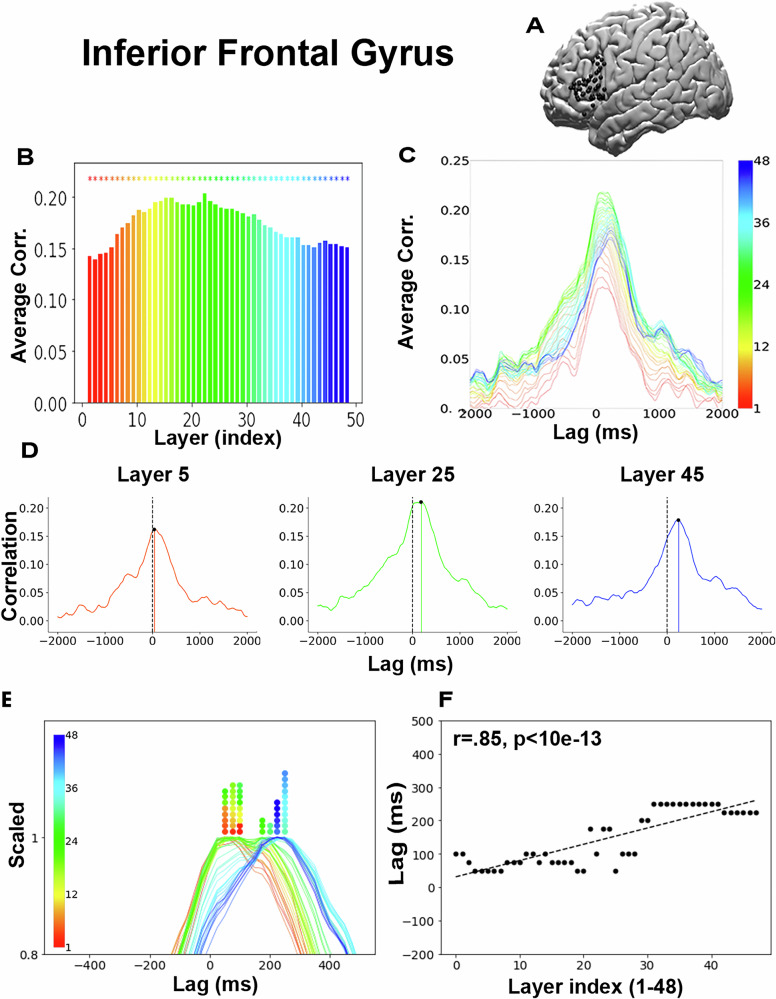Secuencia temporal del pensamiento. Los paneles muestran que las capas simples de la IA (rojo) predicen la actividad cerebral inmediata, mientras que las capas profundas (azul) coinciden con el procesamiento tardío, demostrando que entender requiere tiempo. | Créditos: Nature