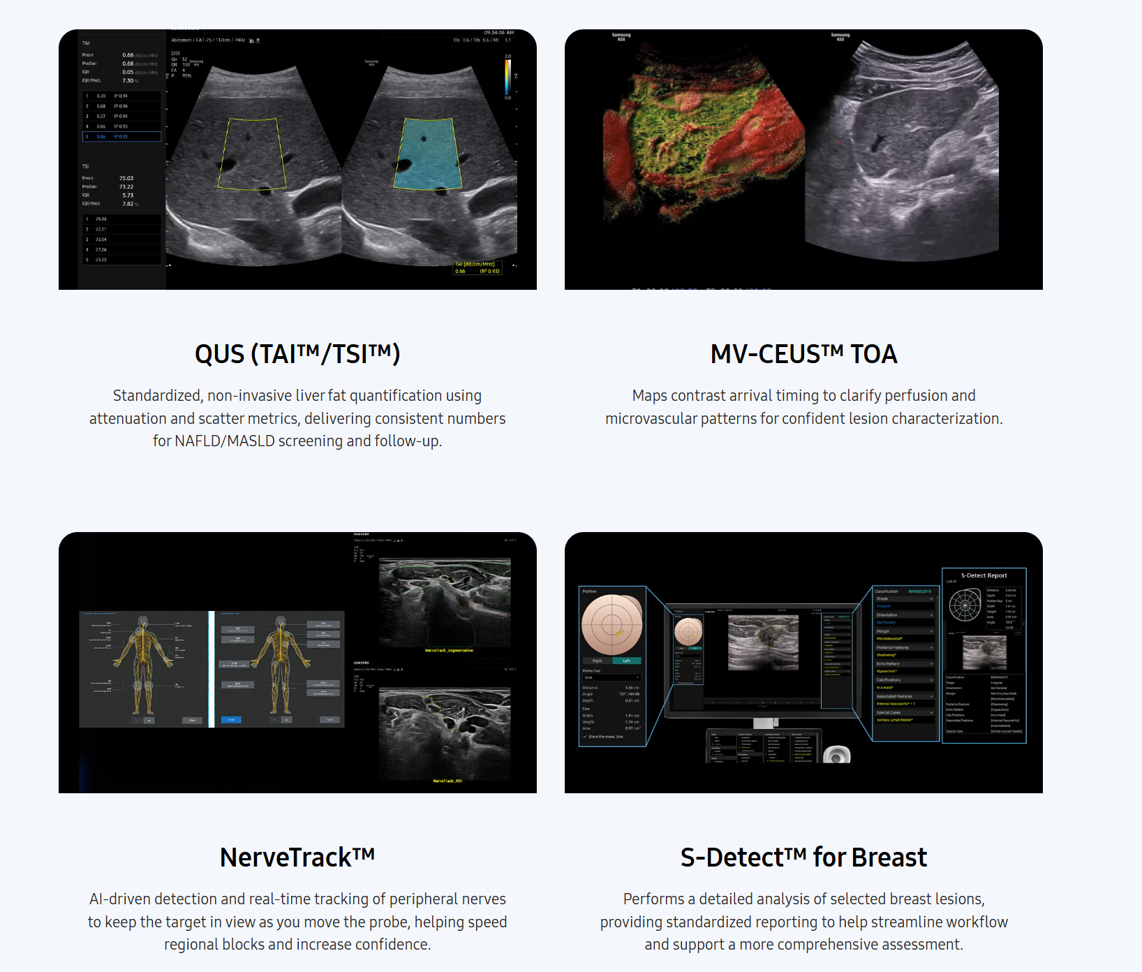 Cuatro funciones clínicas del sistema de ultrasonido R20 | Créditos: Samsung